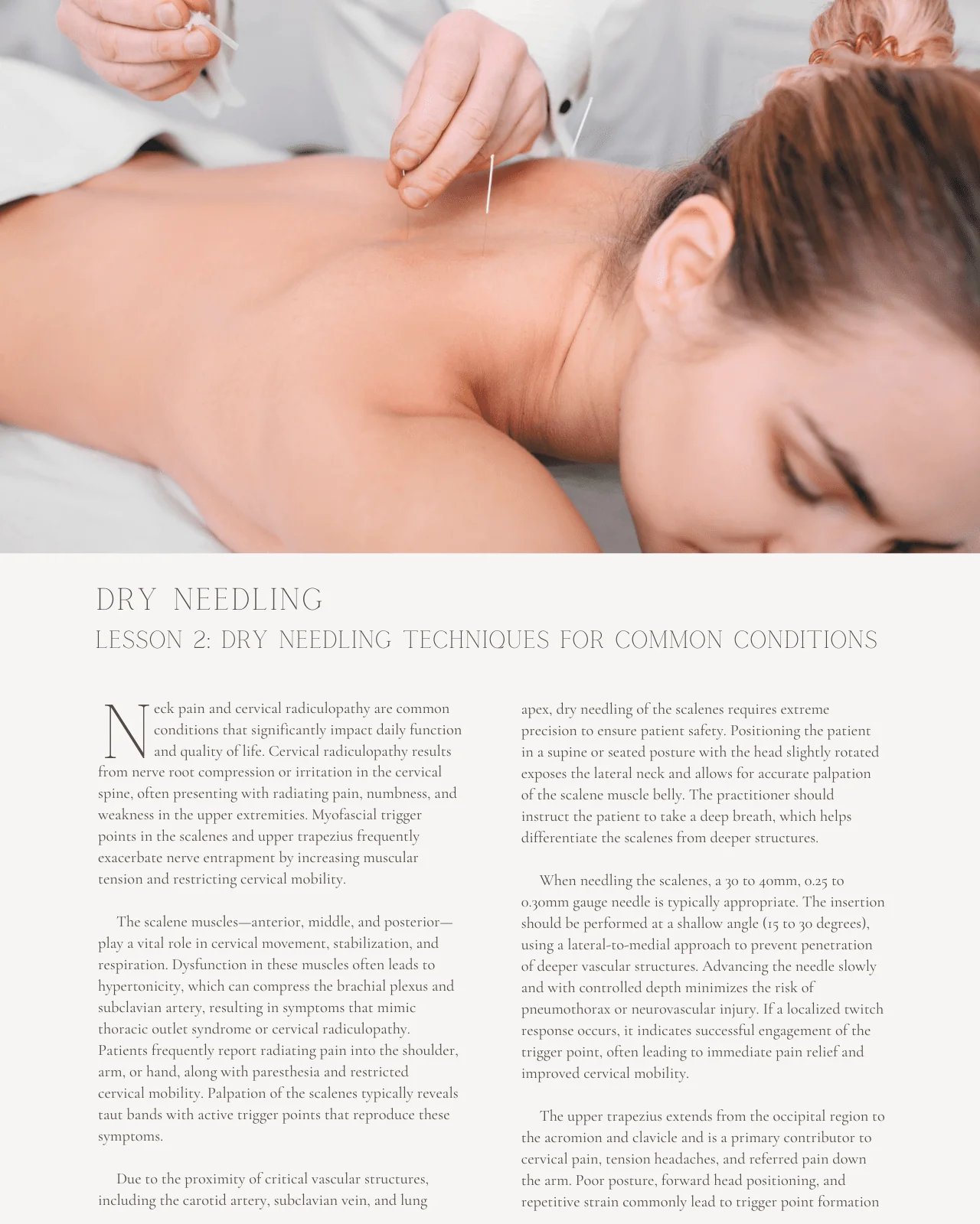 Dry Needling: Fundamentals and Clinical Applications for Common Conditions - Chiropractic Continuing Education, Acupuncture, 2 Hours - Image 3